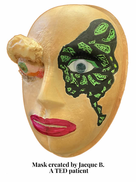 mask showing thyroid eye disease TED with bulging eye.
