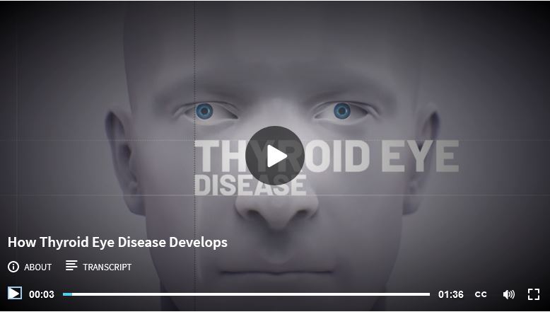 Ted Community Organization Thyroid Eye Disease Solutions Organization 8536