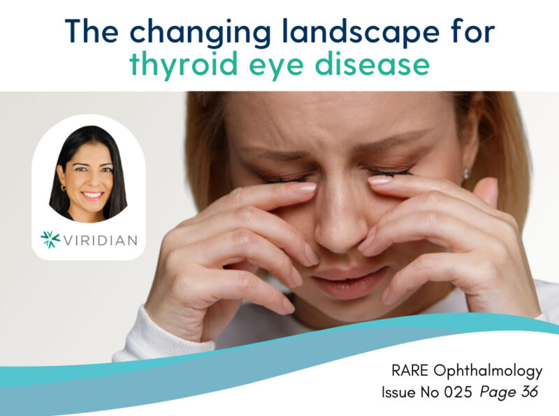 thyroid eye disease doctors perspective rare revolution article